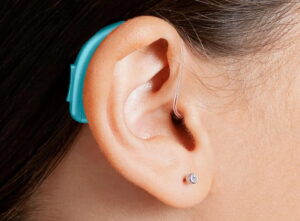 hearing aid centres in Gold Coast